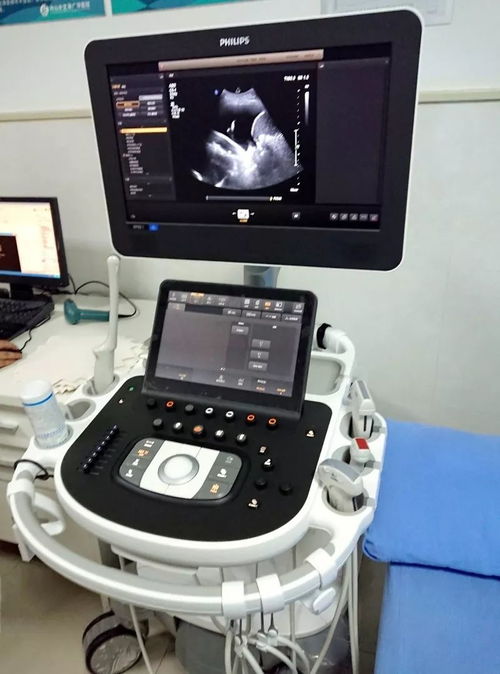 超声检查再添利器，来广华体验国际高端彩超设备